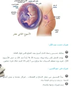 1542831072753.webp
