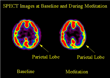 prayer-brain-active-02.gif