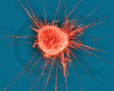 cancer-cell.jpg