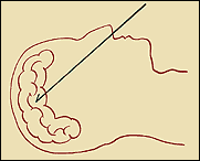 brain10.gif