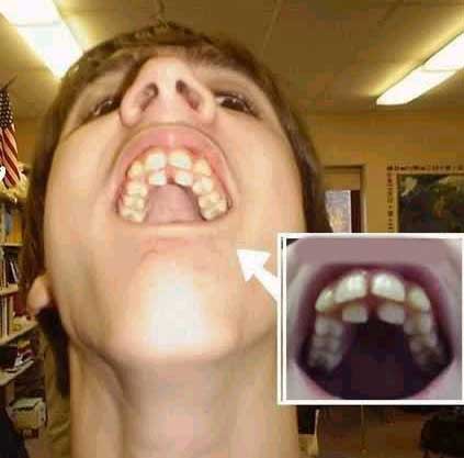 dents.jpg
