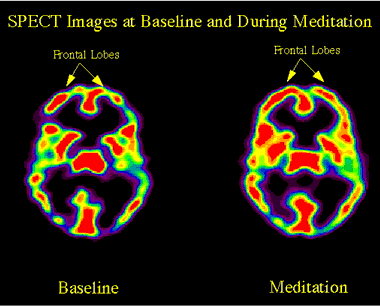 prayer-brain-active-01.gif