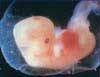 fetaldevelopment6.jpg