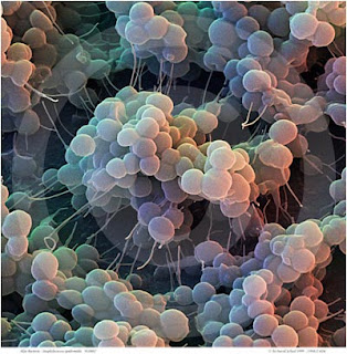199812-026-Staph-Bacteria.jpg