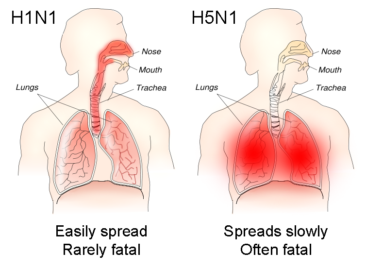 H1N1_versus_H5N1_pathology.png