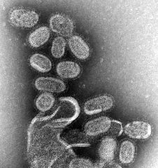 226px-EM_of_influenza_virus.jpg